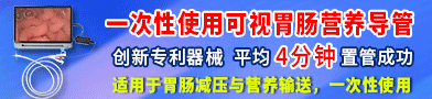 一次性使用可視胃腸營(yíng)養(yǎng)導(dǎo)管/可視小腸減壓管/低頻脈沖治療儀（止吐）-廣州市如本生物科技有限公司