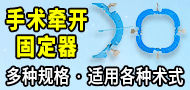 牽開(kāi)固定器/手術(shù)牽開(kāi)固定器/一次性使用外科牽開(kāi)固定器-上海鋆通醫(yī)療科技發(fā)展有限公司