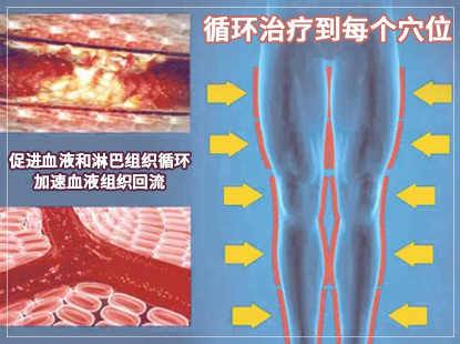 空气波压力综合治疗仪,空气波,空气波压力循环仪,空气波四肢循环仪