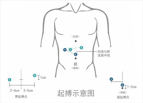 音乐胃肠多功能治疗仪